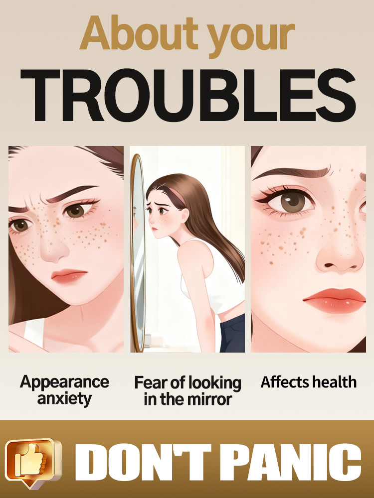 Lightening Facial Freckles Mel - đánh giá và giá Skincare Luxury Whitening