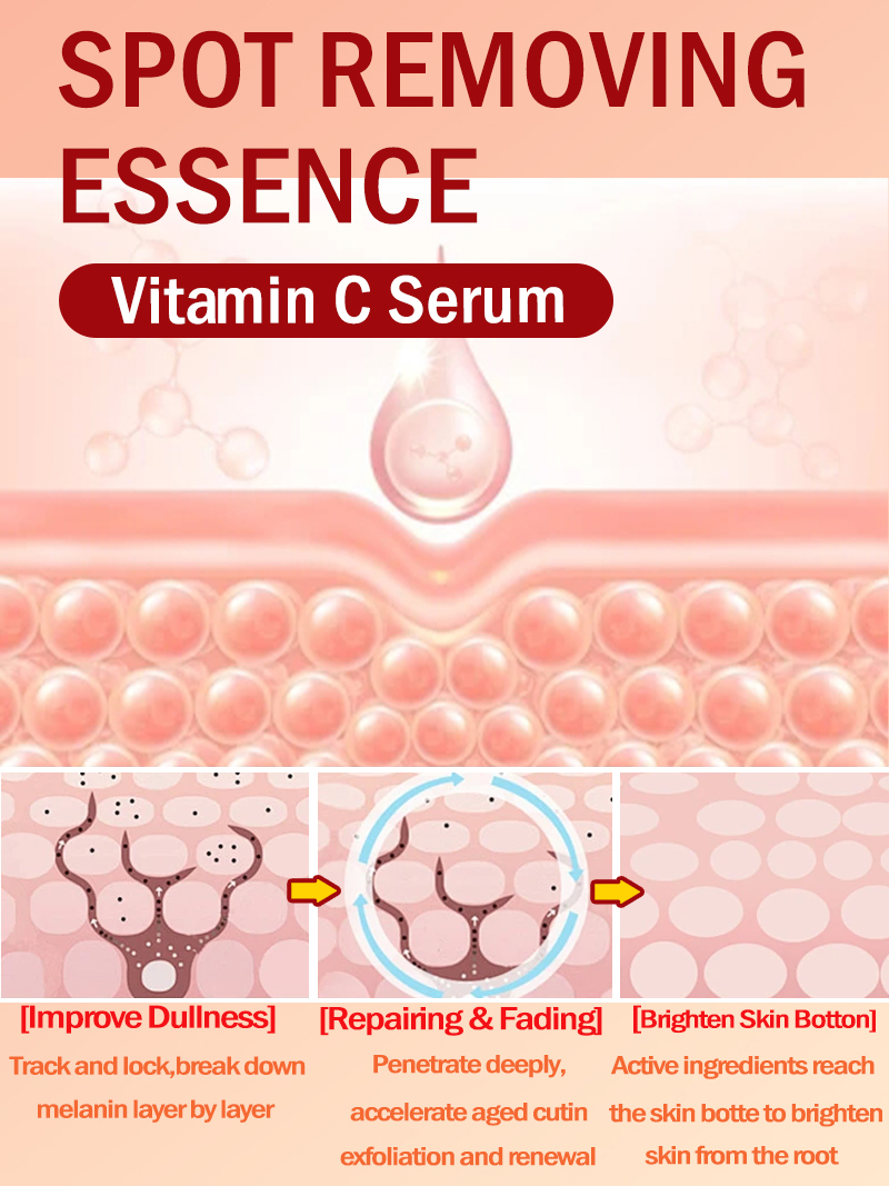 Lighten Freckles Melasma, Faci - đánh giá và giá Skincare Luxury Whitening